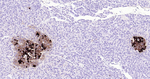 Somatostatin Antibody in Immunohistochemistry (Paraffin) (IHC (P))
