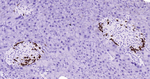 Somatostatin Antibody in Immunohistochemistry (Paraffin) (IHC (P))