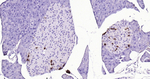Somatostatin Antibody in Immunohistochemistry (Paraffin) (IHC (P))