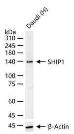 SHIP1 Antibody in Western Blot (WB)