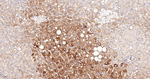 IQGAP2 Antibody in Immunohistochemistry (Paraffin) (IHC (P))