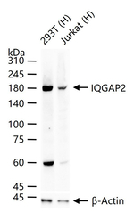 IQGAP2 Antibody in Western Blot (WB)