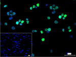 IRF4 Recombinant Rabbit Monoclonal Antibody (10H6)