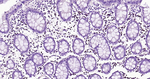 IRF4 Antibody in Immunohistochemistry (Paraffin) (IHC (P))