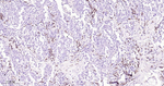 IRF4 Antibody in Immunohistochemistry (Paraffin) (IHC (P))