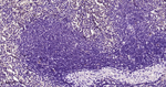 IRF4 Antibody in Immunohistochemistry (Paraffin) (IHC (P))