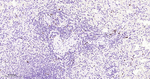 IRF4 Antibody in Immunohistochemistry (Paraffin) (IHC (P))