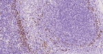 IRF4 Antibody in Immunohistochemistry (Paraffin) (IHC (P))