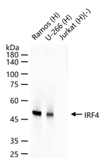 IRF4 Antibody in Western Blot (WB)
