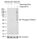 Phospho-MST1/MST2 (Thr183, Thr180) Recombinant Rabbit Monoclonal Antibody (2D13)