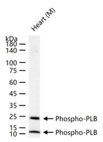 Phospho-Phospholamban (Ser16) Antibody in Western Blot (WB)