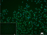 ISL1 Recombinant Rabbit Monoclonal Antibody (14H4)