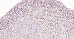 ISL1 Antibody in Immunohistochemistry (Paraffin) (IHC (P))