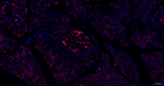 ISL1 Antibody in Immunohistochemistry (Paraffin) (IHC (P))