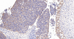 CD51 Antibody in Immunohistochemistry (Paraffin) (IHC (P))