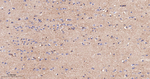 CD51 Antibody in Immunohistochemistry (Paraffin) (IHC (P))