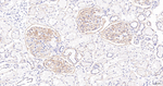 CD51 Antibody in Immunohistochemistry (Paraffin) (IHC (P))