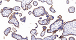 CD51 Antibody in Immunohistochemistry (Paraffin) (IHC (P))