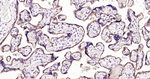 CD51 Antibody in Immunohistochemistry (Paraffin) (IHC (P))