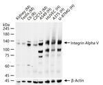 CD51 Antibody in Western Blot (WB)