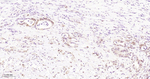 Phospho-4EBP1/2/3 (Thr46, Thr46, Thr32) Recombinant Rabbit Monoclonal Antibody (3A4)