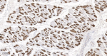 MYH2 Antibody in Immunohistochemistry (Paraffin) (IHC (P))