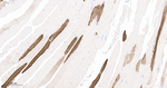 MYH2 Recombinant Rabbit Monoclonal Antibody (1G6)