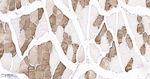 MYH2 Antibody in Immunohistochemistry (Paraffin) (IHC (P))