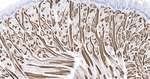 MYH2 Antibody in Immunohistochemistry (Paraffin) (IHC (P))