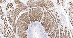 MYH2 Antibody in Immunohistochemistry (Paraffin) (IHC (P))