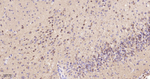 Phospho-PKA alpha/beta/gamma (Thr197) Antibody in Immunohistochemistry (Paraffin) (IHC (P))