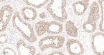 Phospho-PKA alpha/beta/gamma (Thr197) Antibody in Immunohistochemistry (Paraffin) (IHC (P))