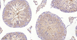 Phospho-PKA alpha/beta/gamma (Thr197) Antibody in Immunohistochemistry (Paraffin) (IHC (P))