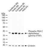 Phospho-PKA alpha/beta/gamma (Thr197) Antibody in Western Blot (WB)