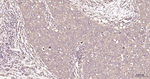 LDHA Antibody in Immunohistochemistry (Paraffin) (IHC (P))