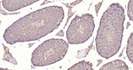 LDHA Antibody in Immunohistochemistry (Paraffin) (IHC (P))