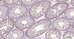 LDHA Antibody in Immunohistochemistry (Paraffin) (IHC (P))