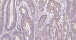 LDHA Antibody in Immunohistochemistry (Paraffin) (IHC (P))
