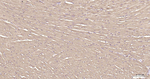 LDHA Antibody in Immunohistochemistry (Paraffin) (IHC (P))