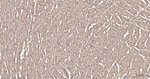 LDHA Antibody in Immunohistochemistry (Paraffin) (IHC (P))