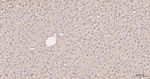 LDHA Antibody in Immunohistochemistry (Paraffin) (IHC (P))