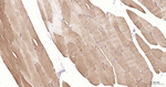 LDHA Recombinant Rabbit Monoclonal Antibody (18A13)