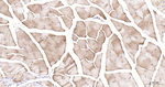 LDHA Antibody in Immunohistochemistry (Paraffin) (IHC (P))