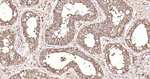 LDHA Antibody in Immunohistochemistry (Paraffin) (IHC (P))
