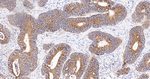ERp72 Antibody in Immunohistochemistry (Paraffin) (IHC (P))