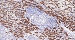ERp72 Antibody in Immunohistochemistry (Paraffin) (IHC (P))