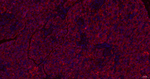ERp72 Antibody in Immunohistochemistry (Paraffin) (IHC (P))