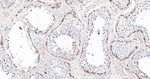 ERp72 Antibody in Immunohistochemistry (Paraffin) (IHC (P))