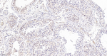 BCLAF1 Antibody in Immunohistochemistry (Paraffin) (IHC (P))