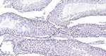 BCLAF1 Antibody in Immunohistochemistry (Paraffin) (IHC (P))